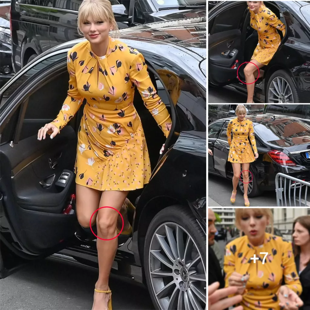“Sunshine Style: Taylor Swift Rocks a Floral Dress and Flaunts Her Lovely Legs at a Parisian Radio Station”